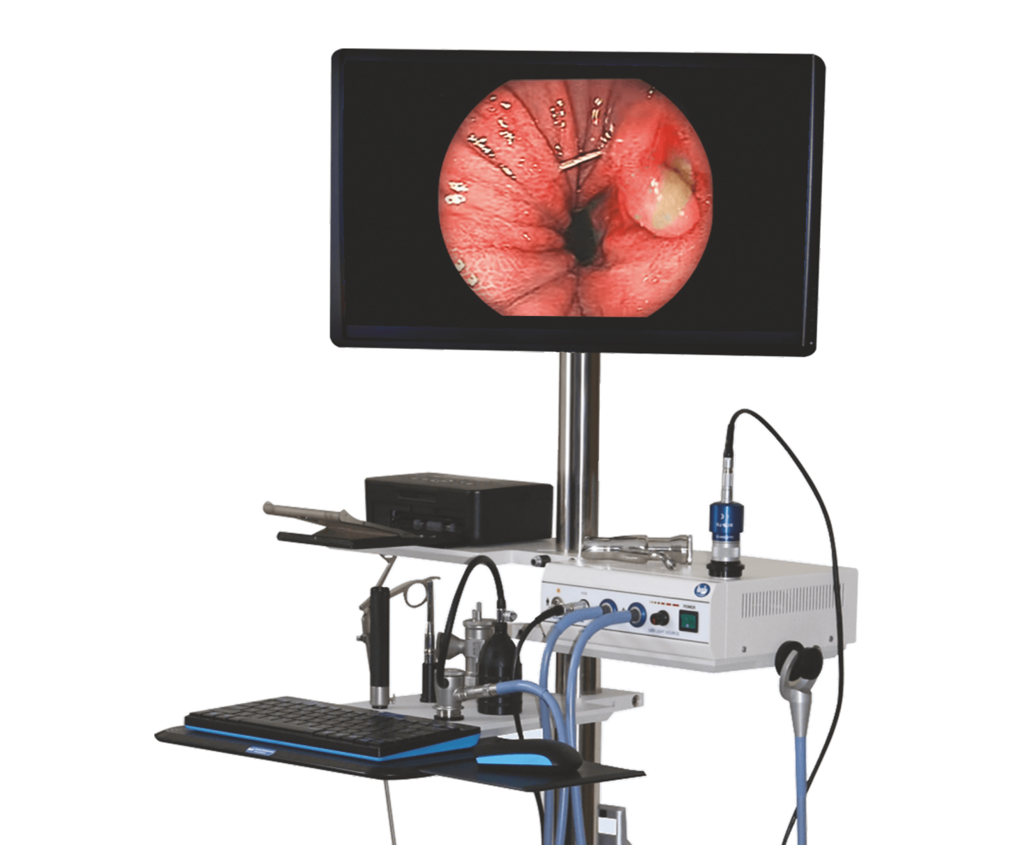 Computerised VDO Anoscopy